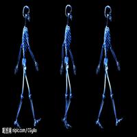Gait analysis
